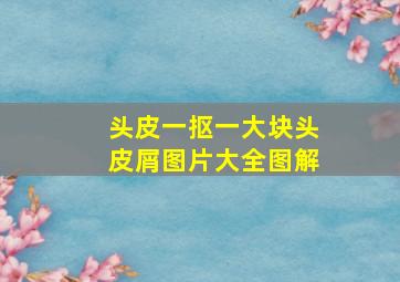 头皮一抠一大块头皮屑图片大全图解