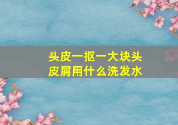 头皮一抠一大块头皮屑用什么洗发水