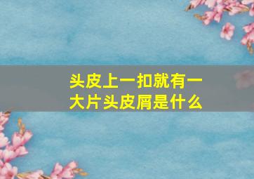 头皮上一扣就有一大片头皮屑是什么