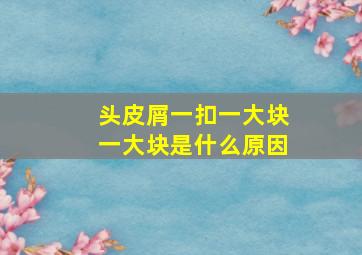 头皮屑一扣一大块一大块是什么原因