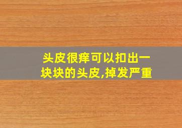 头皮很痒可以扣出一块块的头皮,掉发严重