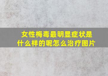 女性梅毒最明显症状是什么样的呢怎么治疗图片