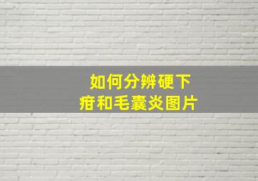 如何分辨硬下疳和毛囊炎图片