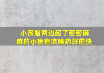 小孩脸两边起了密密麻麻的小疙瘩吃啥药好的快