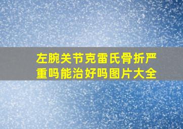 左腕关节克雷氏骨折严重吗能治好吗图片大全