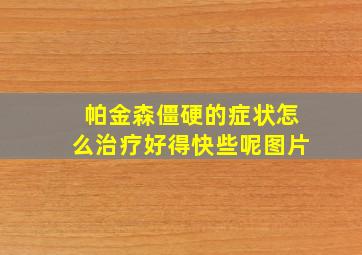 帕金森僵硬的症状怎么治疗好得快些呢图片