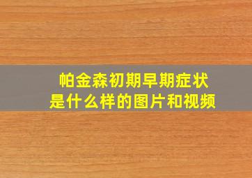 帕金森初期早期症状是什么样的图片和视频