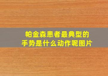 帕金森患者最典型的手势是什么动作呢图片