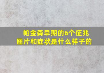 帕金森早期的6个征兆图片和症状是什么样子的