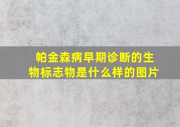 帕金森病早期诊断的生物标志物是什么样的图片