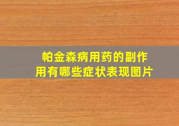 帕金森病用药的副作用有哪些症状表现图片