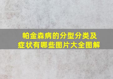 帕金森病的分型分类及症状有哪些图片大全图解