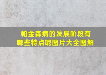 帕金森病的发展阶段有哪些特点呢图片大全图解