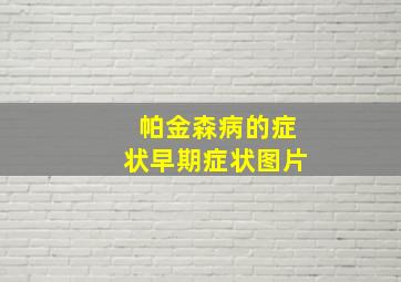 帕金森病的症状早期症状图片