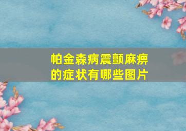 帕金森病震颤麻痹的症状有哪些图片