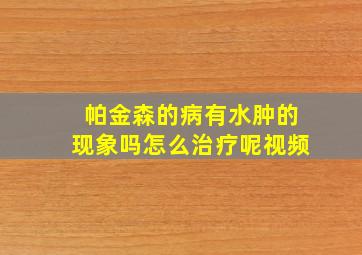 帕金森的病有水肿的现象吗怎么治疗呢视频