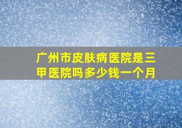 广州市皮肤病医院是三甲医院吗多少钱一个月