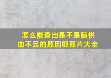 怎么能查出是不是脑供血不足的原因呢图片大全