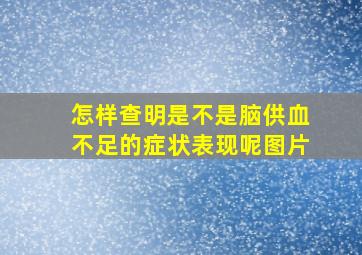 怎样查明是不是脑供血不足的症状表现呢图片