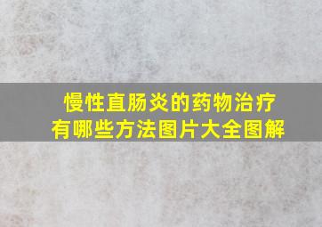 慢性直肠炎的药物治疗有哪些方法图片大全图解