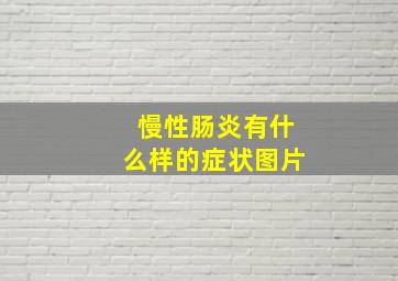 慢性肠炎有什么样的症状图片