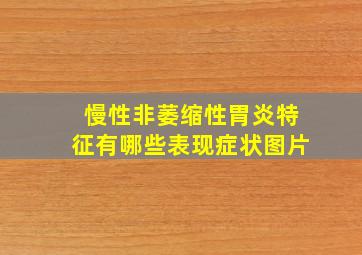 慢性非萎缩性胃炎特征有哪些表现症状图片