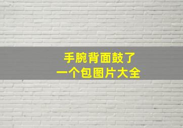 手腕背面鼓了一个包图片大全