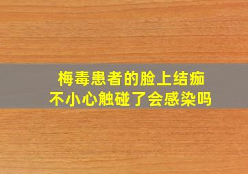 梅毒患者的脸上结痂不小心触碰了会感染吗