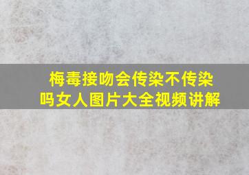 梅毒接吻会传染不传染吗女人图片大全视频讲解