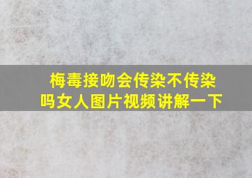 梅毒接吻会传染不传染吗女人图片视频讲解一下