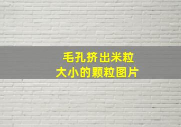 毛孔挤出米粒大小的颗粒图片