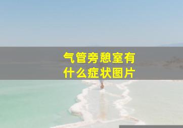 气管旁憩室有什么症状图片