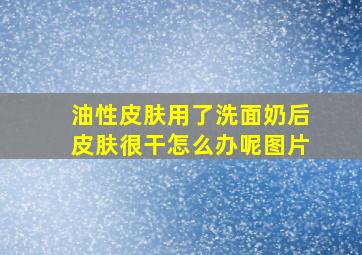 油性皮肤用了洗面奶后皮肤很干怎么办呢图片