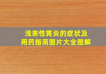 浅表性胃炎的症状及用药指南图片大全图解