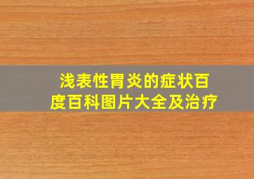 浅表性胃炎的症状百度百科图片大全及治疗