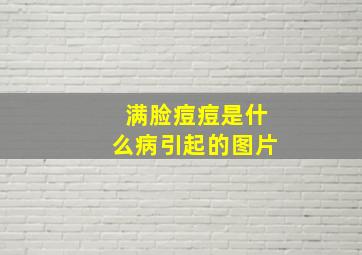 满脸痘痘是什么病引起的图片