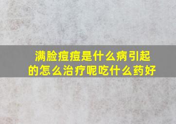 满脸痘痘是什么病引起的怎么治疗呢吃什么药好