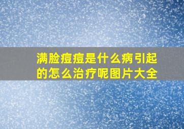 满脸痘痘是什么病引起的怎么治疗呢图片大全