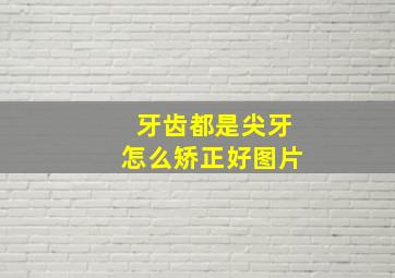 牙齿都是尖牙怎么矫正好图片