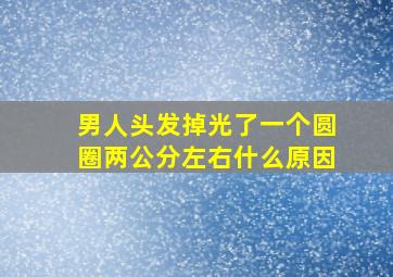 男人头发掉光了一个圆圈两公分左右什么原因