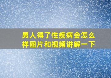 男人得了性疾病会怎么样图片和视频讲解一下