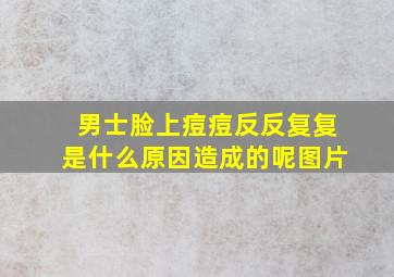 男士脸上痘痘反反复复是什么原因造成的呢图片