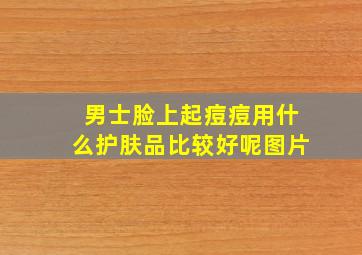 男士脸上起痘痘用什么护肤品比较好呢图片