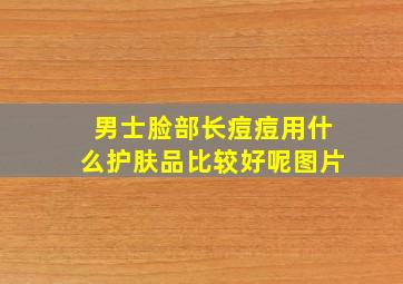 男士脸部长痘痘用什么护肤品比较好呢图片