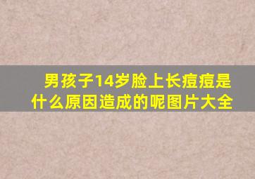 男孩子14岁脸上长痘痘是什么原因造成的呢图片大全