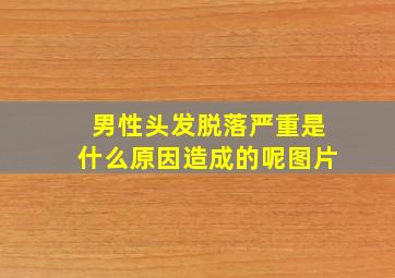 男性头发脱落严重是什么原因造成的呢图片