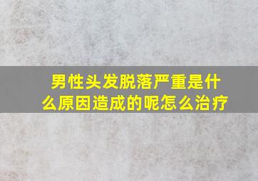 男性头发脱落严重是什么原因造成的呢怎么治疗