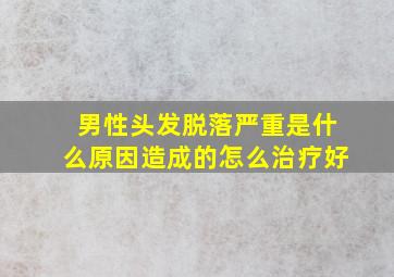 男性头发脱落严重是什么原因造成的怎么治疗好