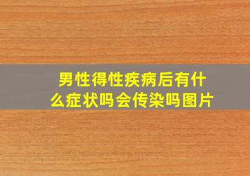 男性得性疾病后有什么症状吗会传染吗图片