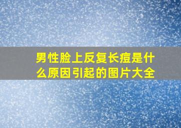 男性脸上反复长痘是什么原因引起的图片大全